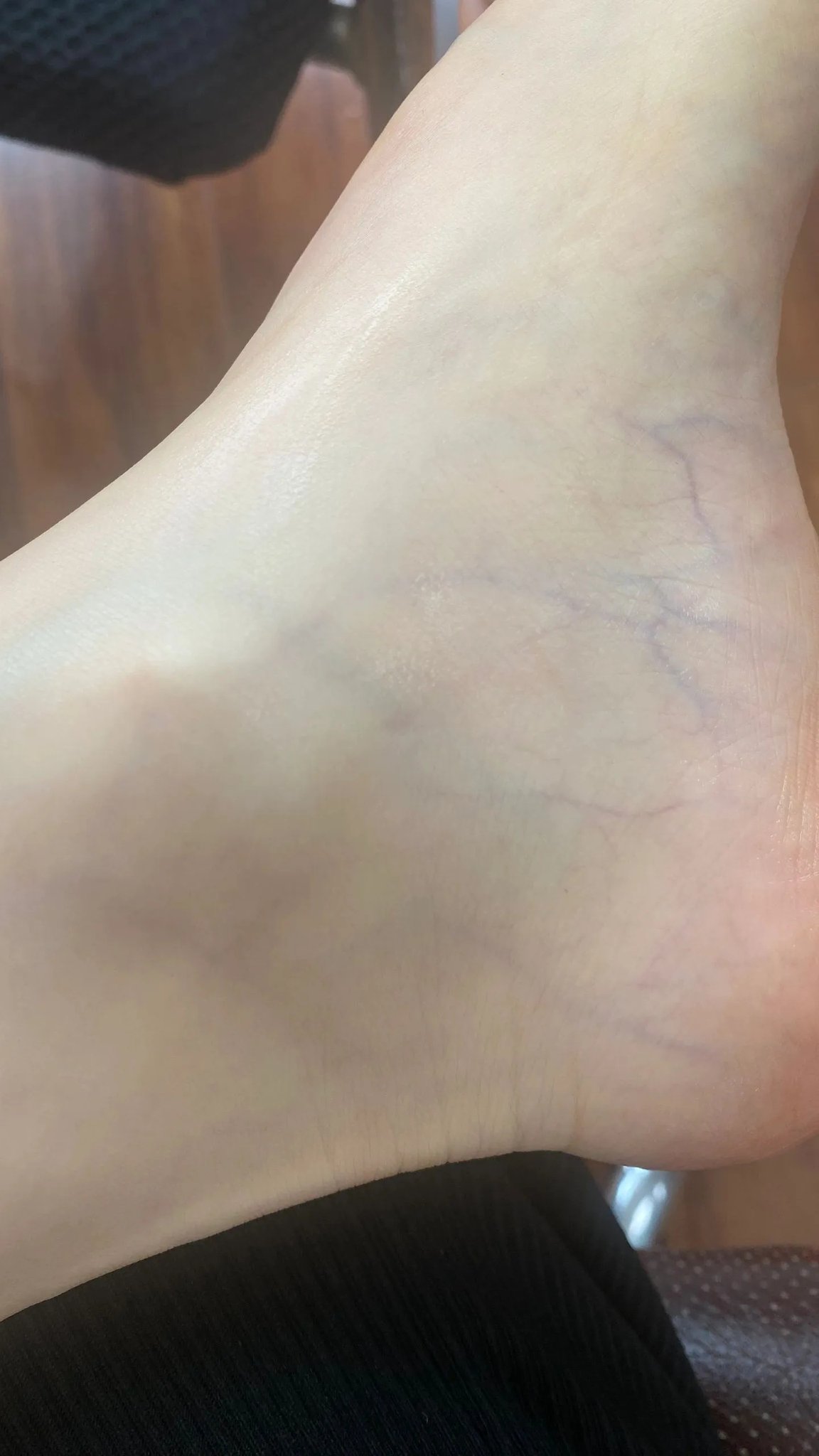 各種腳，包括黃圣依的